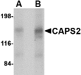 CADPS2 Antibody - BSA Free