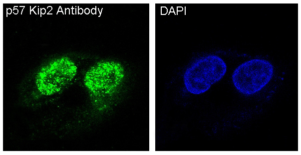 p57 Kip2 Antibody (SR2016) - BSA Free