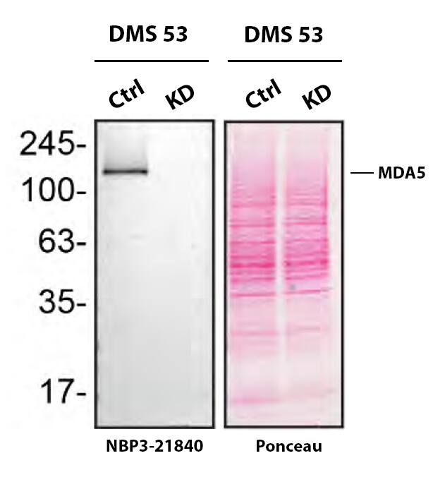 MDA5 Antibody (SR1076) - BSA Free Western Blot Shows MDA5 Specificity Using knockdown Cell Line.