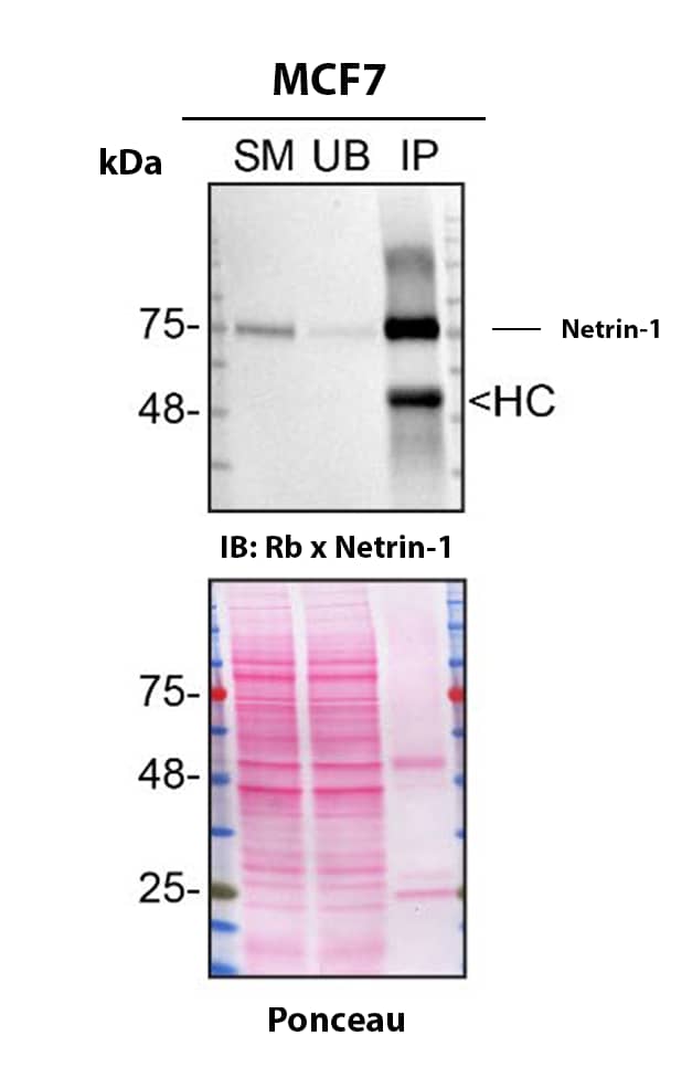 Netrin-1 Antibody (SR2201) - BSA Free Detection of Netrin-1 by Immunoprecipitation.