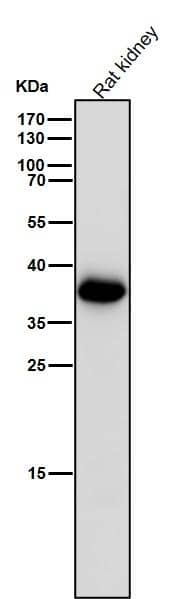 Aldo-keto Reductase 1C3/AKR1C3 Antibody (SR1612)
