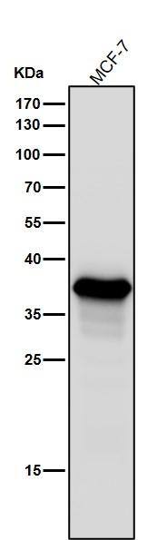 Aldo-keto Reductase 1C3/AKR1C3 Antibody (SR1612)
