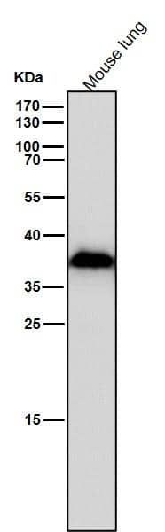 Aldo-keto Reductase 1C3/AKR1C3 Antibody (SR1612)