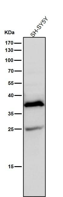 Aldo-keto Reductase 1C3/AKR1C3 Antibody (SR1612)