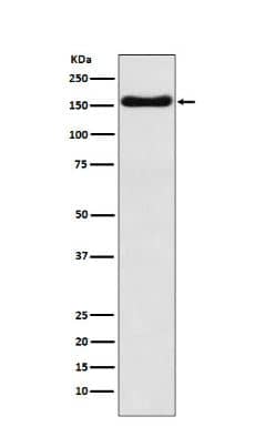 ATP7b Antibody (SR1205)