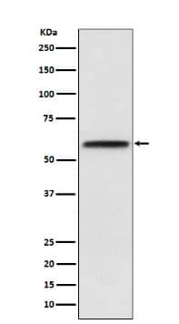 LCAT Antibody (SR1989)