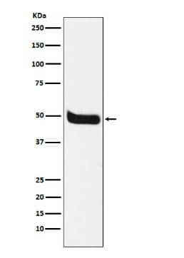 NK1R Antibody (SR1839)