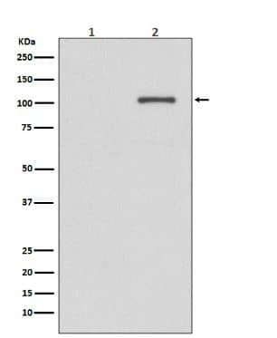 IRE1 alpha [p Ser724] Antibody (SR1062)