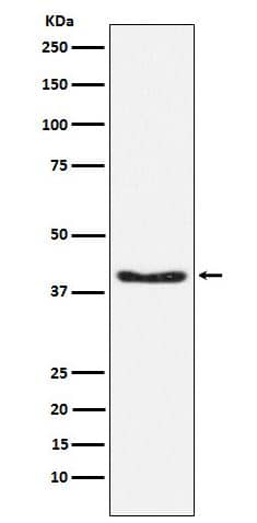 Pyruvate Dehydrogenase E1-alpha subunit [p Ser293] Antibody (SR1677)