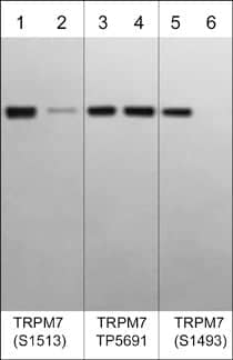 TRPM7 [p Ser1493] Antibody