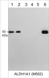 Aldehyde Dehydrogenase 1-A1/ALDH1A1 Antibody (M562)