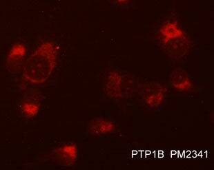 PTP1B/PTPN1 Antibody (M234)