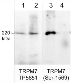 TRPM7 [p Ser1569] Antibody