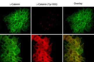 gamma Catenin [p Tyr550] Antibody