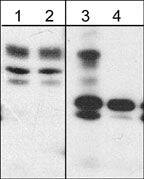 WASF2 [p Tyr150] Antibody