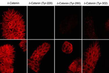 p120-catenin [p Tyr228] Antibody (M356)