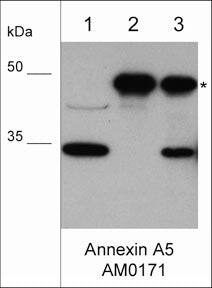 Annexin V Antibody (M017)