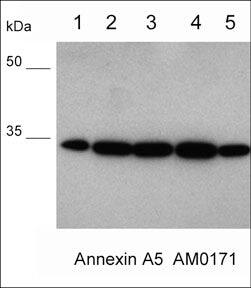 Annexin V Antibody (M017)