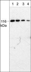 PYK2/FAK2 Antibody (M229)