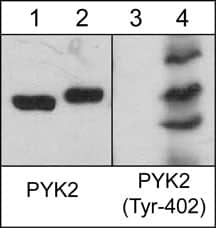 PYK2/FAK2 [p Tyr402] Antibody (M269)