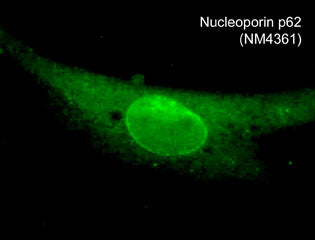 NUP62 Antibody (M436)