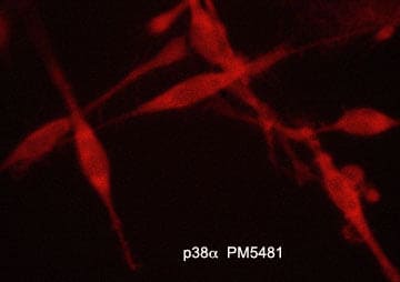 p38 alpha Antibody (M548)