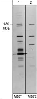 TRPM8 Antibody (M571)