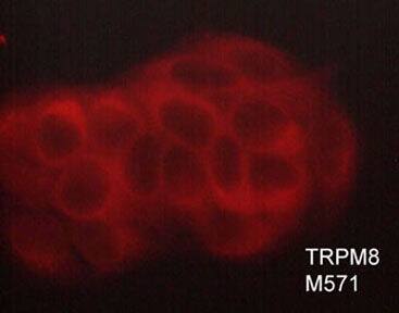 TRPM8 Antibody (M571)