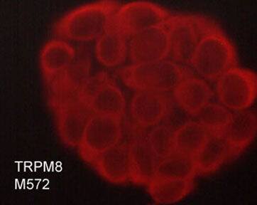TRPM8 Antibody (M572)
