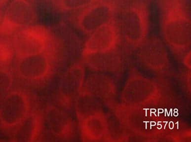 TRPM8 Antibody