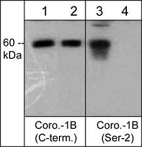 CORO1B Antibody