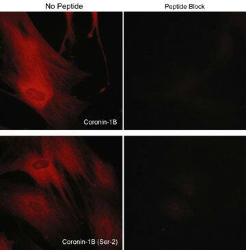 CORO1B [p Ser2] Antibody