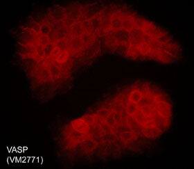 VASP Antibody (M277)