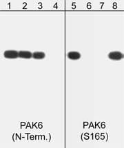 PAK6 [p Ser165] Antibody