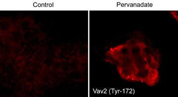 VAV2 [p Tyr172] Antibody