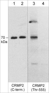 CRMP2 [p Thr555] Antibody (M539)