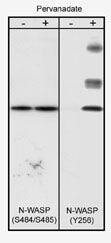 N-WASP [p Tyr256] Antibody