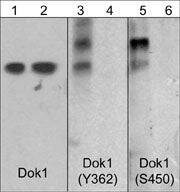 DOK1 [p Tyr362] Antibody