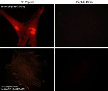 N-WASP [p Ser485, p Ser484] Antibody