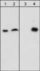 Beta Dystroglycan [p Tyr892] Antibody (M117)