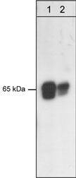 PDK-1 Antibody (M146)