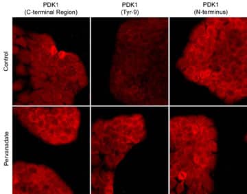 PDK-1 Antibody (M146)