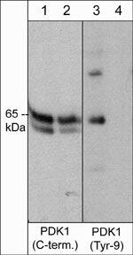 PDK-1 [p Tyr9] Antibody