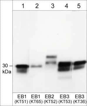 EB3 Antibody (KT53)