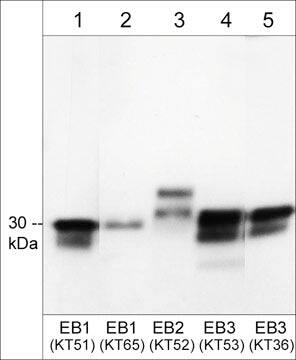 EB3 Antibody (KT36)