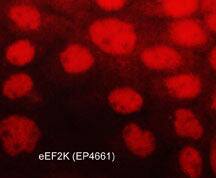 EEF2K Antibody