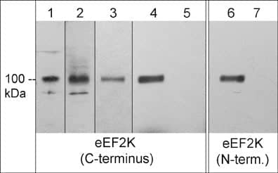 EEF2K Antibody