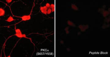 PKC alpha [p Ser657, p Tyr658] Antibody