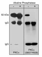 PKC alpha [p Ser657, p Tyr658] Antibody