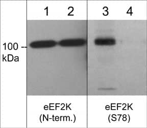 EEF2K [p Ser78] Antibody